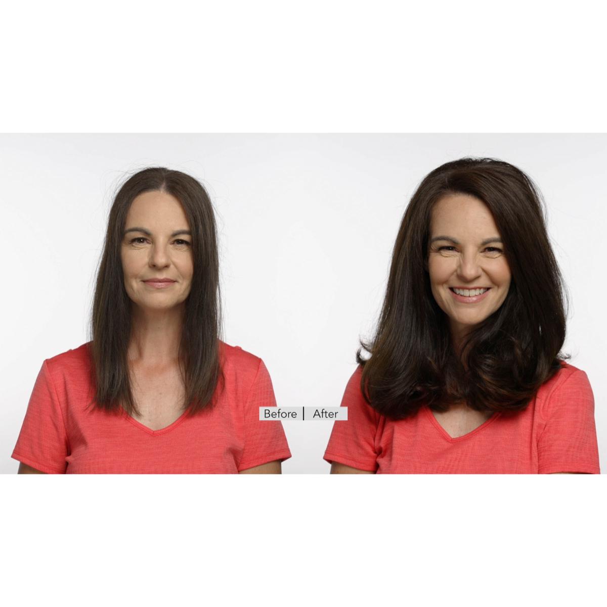 Before and after the Rare Treasures Jatamansi Root Scalp Therapy Soothing Leave-On Serum